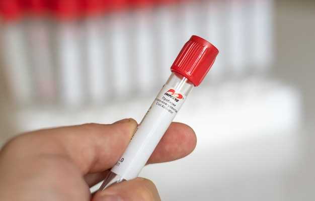 Роль анализа крови на иммуноглобулин Е общий взрослого