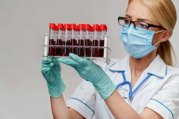 Как подготовиться к сдаче анализа крови на биохимию: