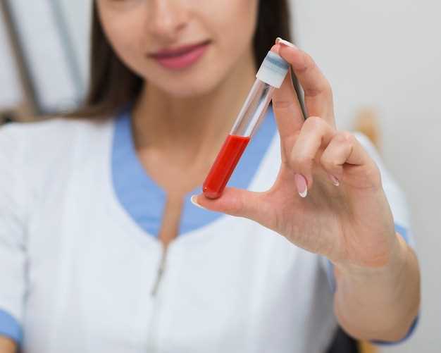 Подготовка к сдаче общего анализа крови