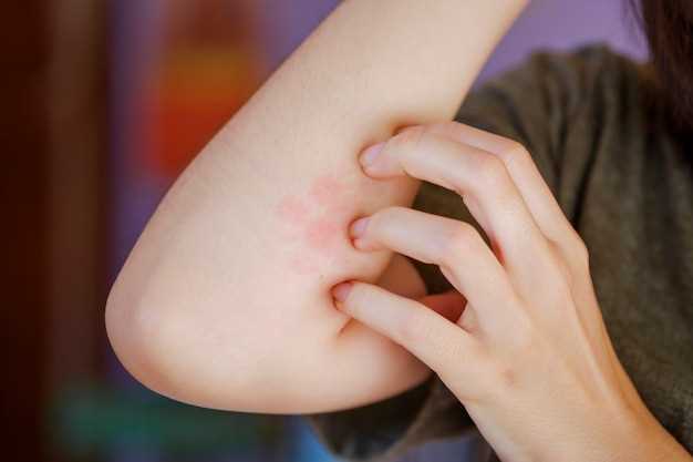 Причины и симптомы аллергического зуда на коже