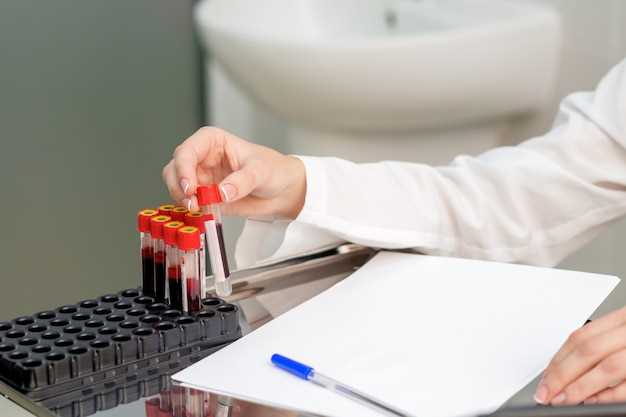 Роль биохимического анализа крови в диагностике