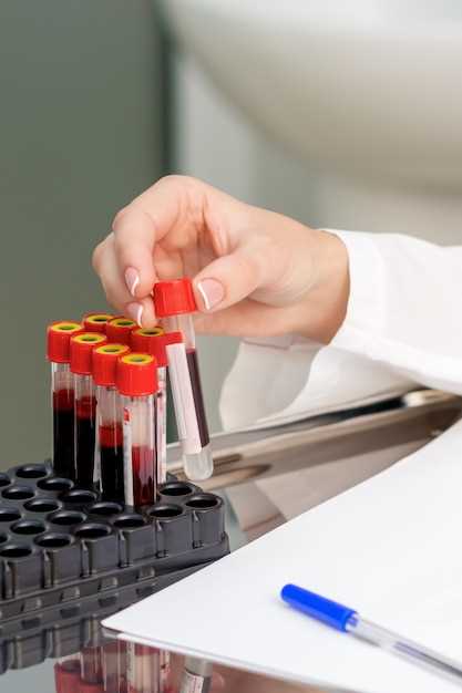 Основные методы диагностики рака при помощи анализа крови