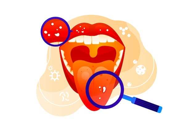 Лечение красного плоского лишая во рту