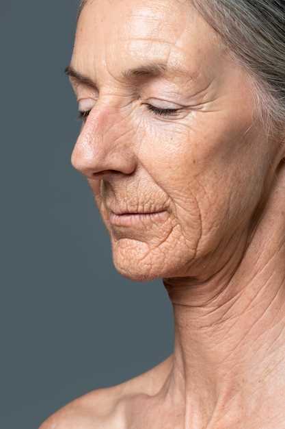 Способы борьбы с мелкоморщинистым типом старения