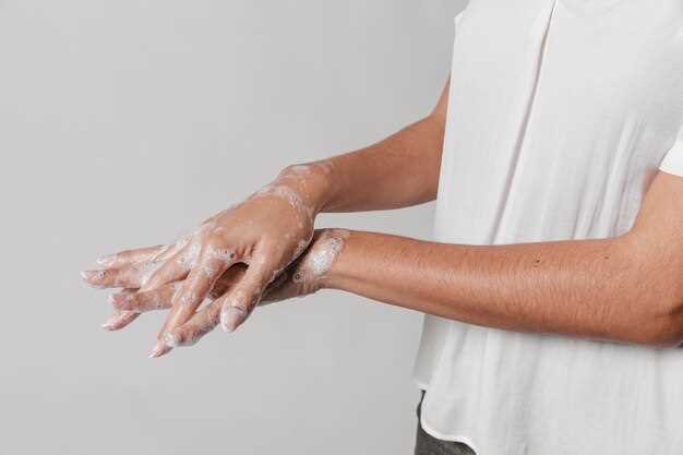 Причины интенсивного потоотделения на ладонях рук
