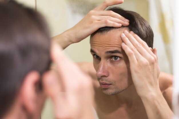Мужская ирвнограмма и выпадение волос